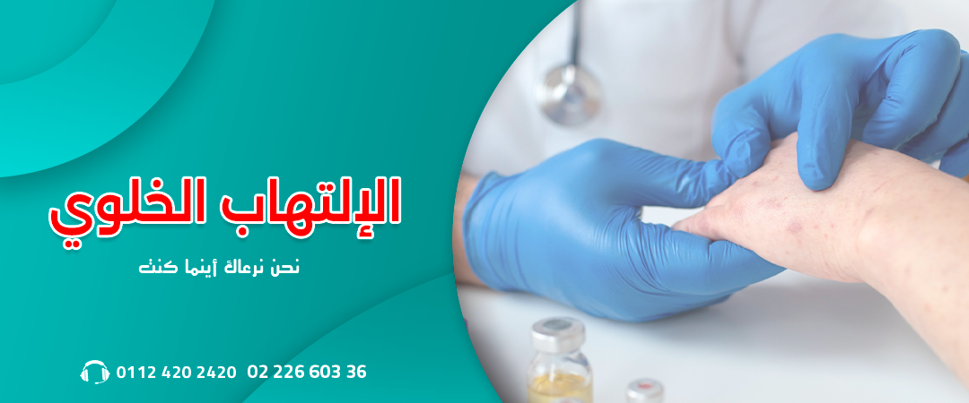 الالتهاب-الخلوي-001.webp