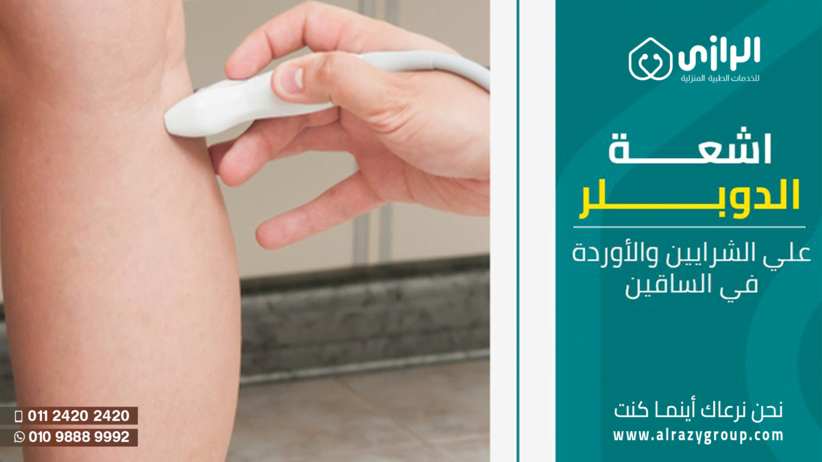 دوبلر2-1200x675.png