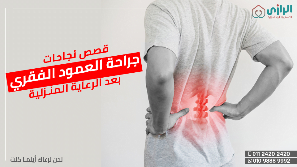 جراحة-العمود-الفقري.png