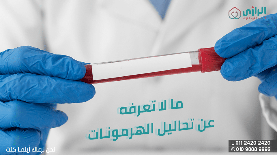 ما-لا-تعرفه-عن-تحاليل-الهرمونات.png
