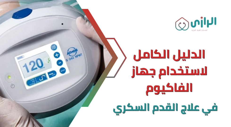 الدليل-الكامل-لاستخدام-جهاز-الفاكيوم-في-علاج-القدم-السكري-1.webp
