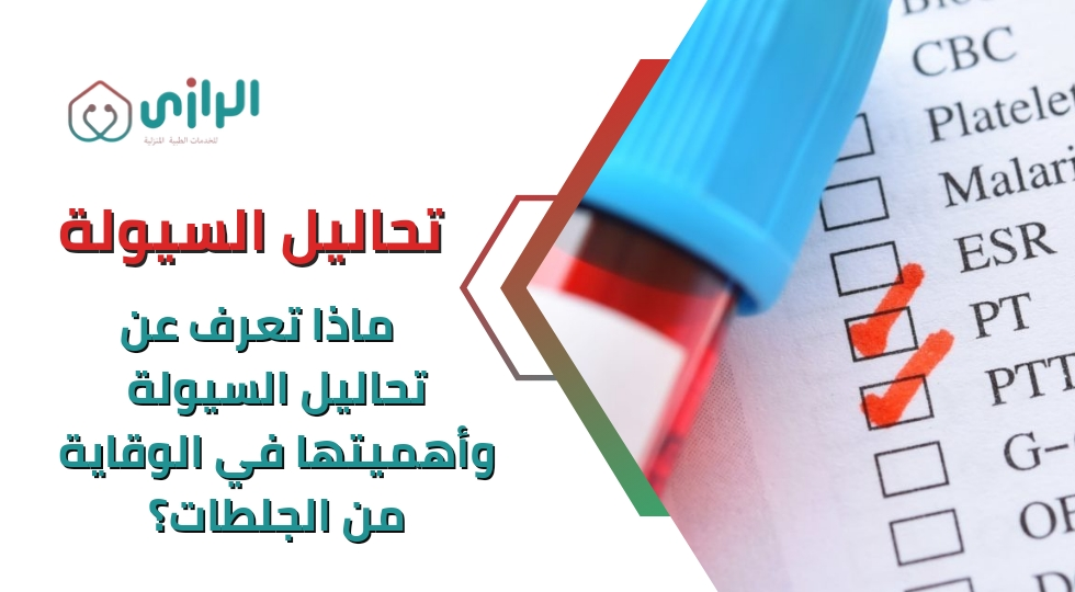 تحاليل-السيولة.webp