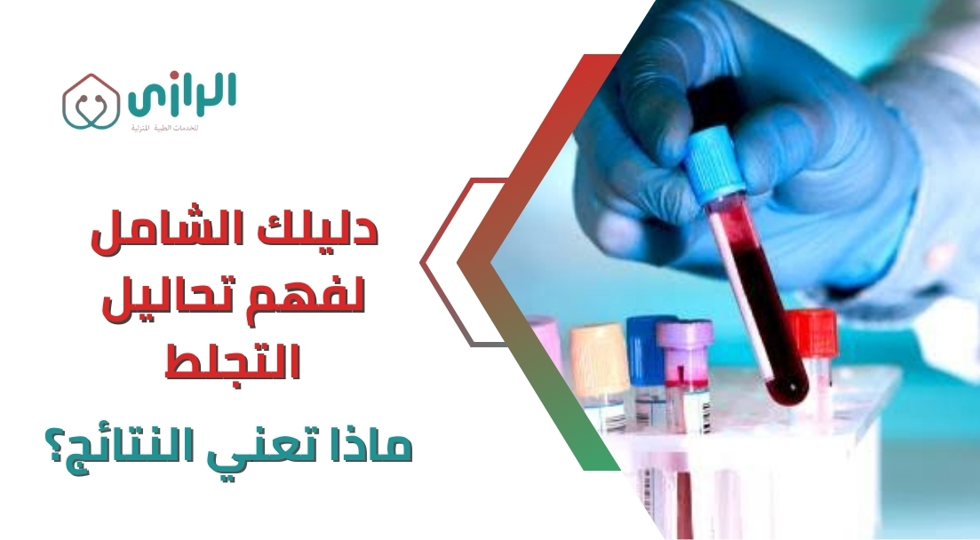 دليلك-الشامل-لفهم-تحاليل-التجلط-ماذا-تعني-النتائج؟.webp