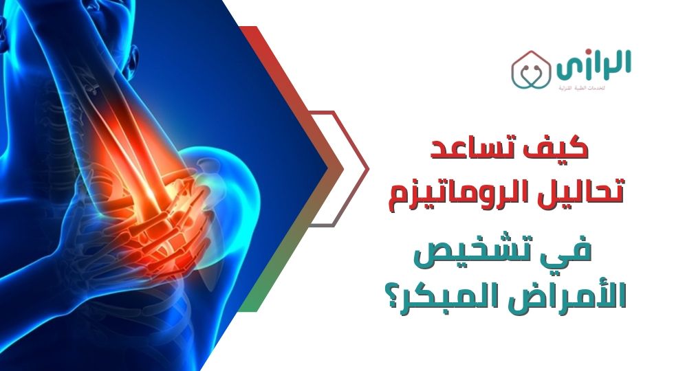 كيف-تساعد-تحاليل-الروماتيزم-في-تشخيص-الأمراض-المبكر؟.webp
