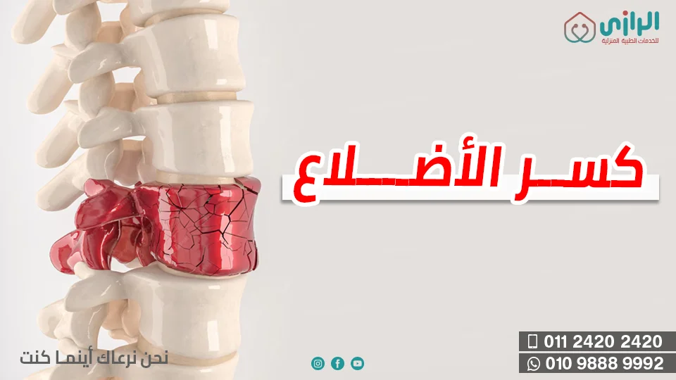 كسر-الأضلاع.webp