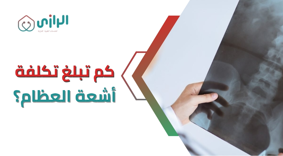 كم-تبلغ-تكلفة-أشعة-العظام؟.webp
