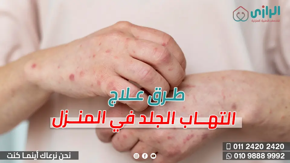 التهاب-الجلد.webp