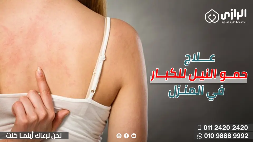 حمو-النيل-في-المنزل-1.webp