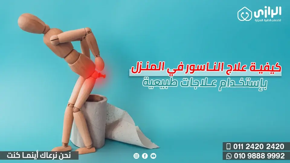 علاج-الناسور.webp