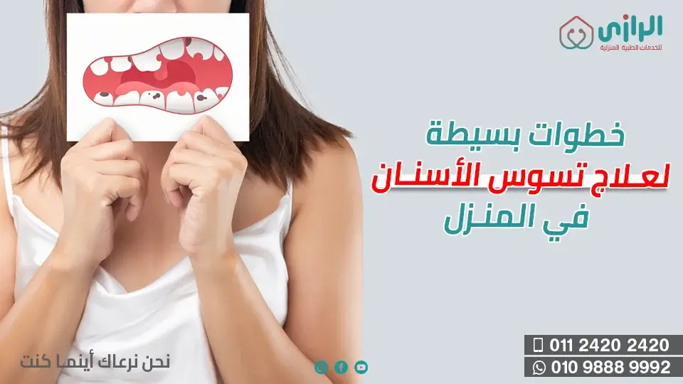 علاج-تسوس-الأسنان.webp