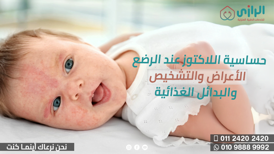حساسية-اللاكتوز-عند-الرضع-الأعراض-والتشخيص-والبدائل-الغذائية22.png