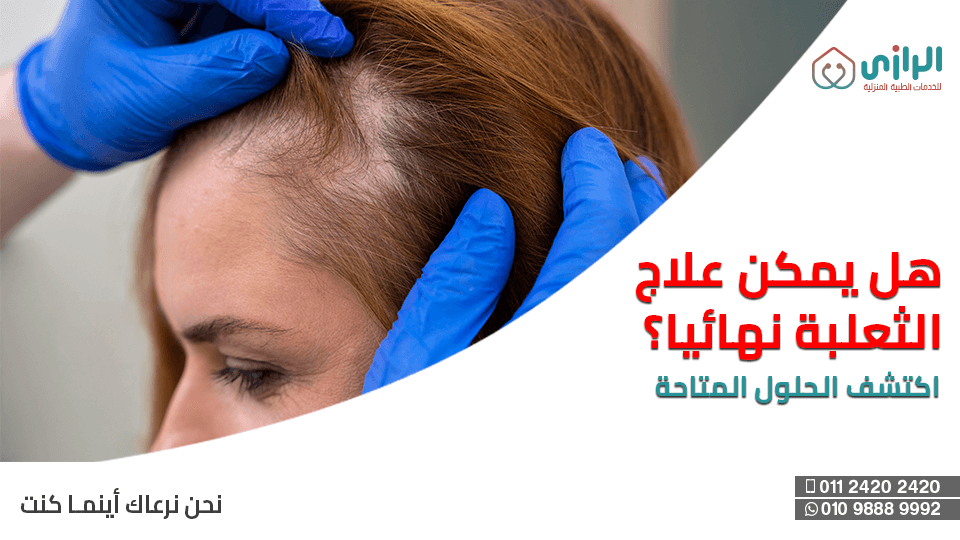 الثعلبه.png