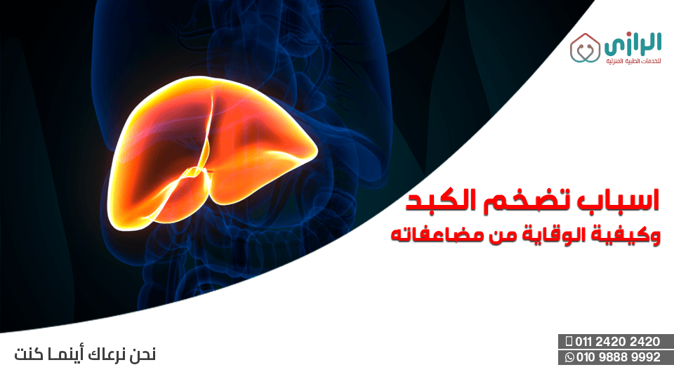 تضخم-الكبد.png