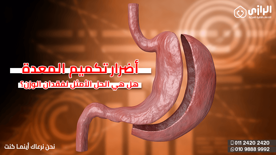 تكميم-المعده.png