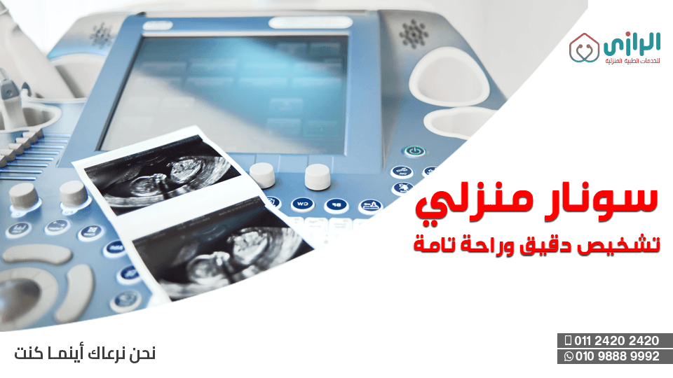 سونار-منزلي.png